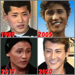 新庄剛志｜整形失敗で顔が変？現在画像が悲惨！目・顎・眉毛の変化が別人？｜Feathered News